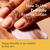 Acure | Crema Corporal para Eczema Sin Aroma | Ayuda