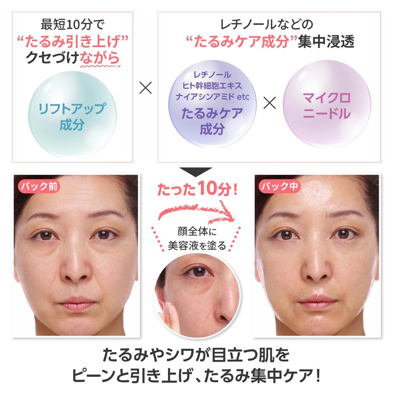 ほうれい線 フェイスライン 目元 たるみ スピードケア パック レチノール マイクロニードル アンスキールタイトジェル50ml