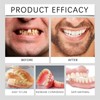 False Teeth Set for Adults,Clip in Veneers Teeth Top and