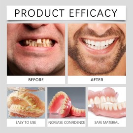 False Teeth Set for Adults,Clip in Veneers Teeth Top and Bottom,Snap On Veneers Teeth,Adjustable Snap-On Dentures,Temporary Teeth Covers,Tooth Veneers for Women and Men,Natural