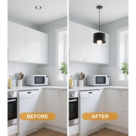 YIIZON Recessed to Pendant Light Converter Kit - 6 Inch Can Light Conversion, Includes E26 Socket, Mounting Bracket, Round Ceiling Plate & 3D White Cover