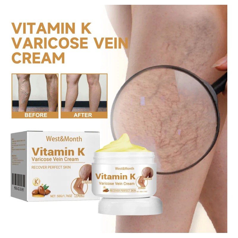 Crema Para Venas Varicosas,alivia Dolor Y Eliminar Varices*2