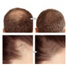 Boobeen Hair Shadow Root Touch Up, Instantly Covers Thinning Hair,
