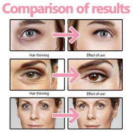 5% Caffeine Eye Cream Eye Serum,Under Eye Serum for Reduce Circles and Puffy Eyes,Under Eye Cream Anti Aging for Dark Circles,Caffeine Eye Serum for Eye Bags and Lines,Resurfacing Caffeine Eye Cream