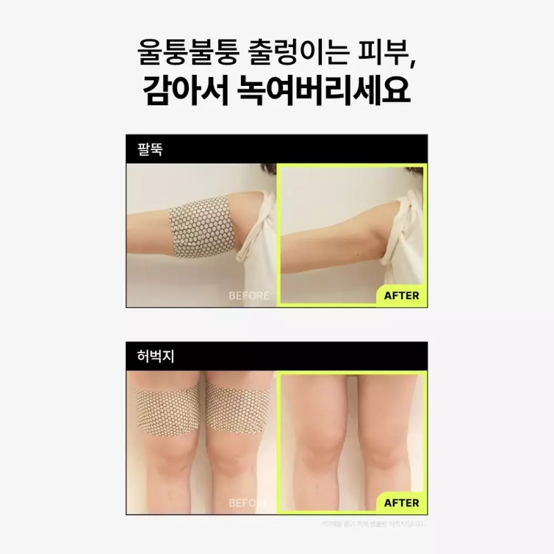 Dr. Ppeu 닥터빼 셀룰라이트 랩핑 패치 CELLULITE WRAPPING PATCH 2개