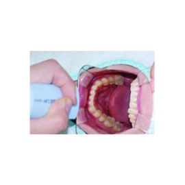 OSUNG - Intraoral Photography Dental Mirror with Handle (Occlusal Medium)