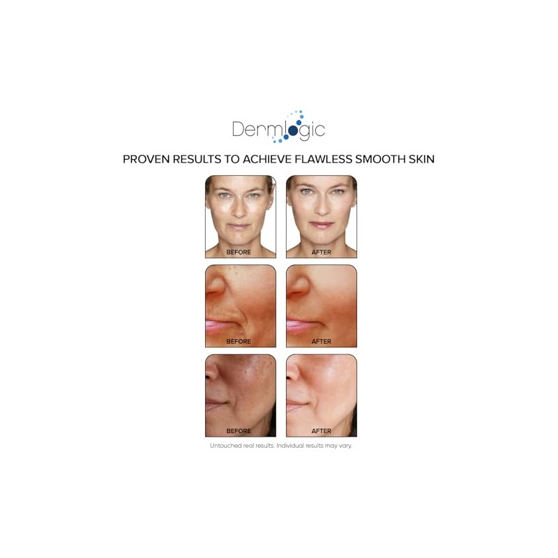 Dermlogic Anti Ageing Resurfacing Peel Pads - Contains Salicylic, Glycolic,