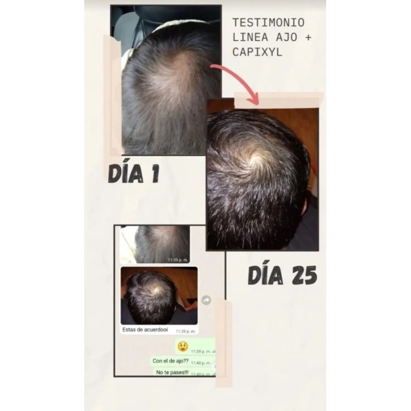Set Reviving Tratamiento Para El Crecimiento Del Cabello
