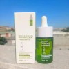 Suero Tratamiento Facial Contra Acné Ácido Salicílico 30ml F Todo