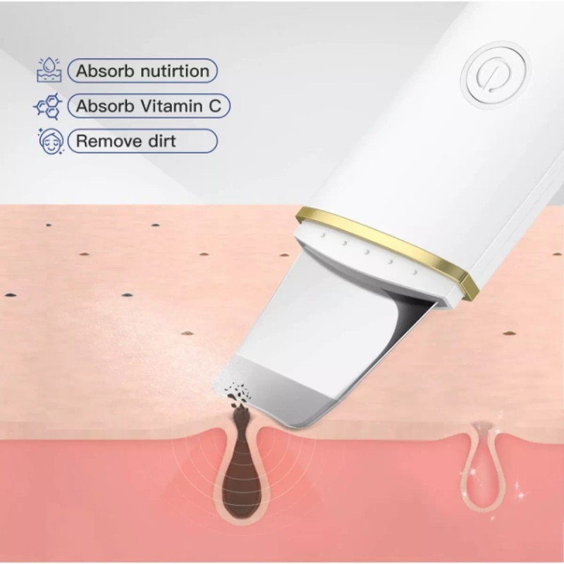 MYBEAUTY Limpiador Facial Peeling Ultrasónico Portatil Skin Scrubber