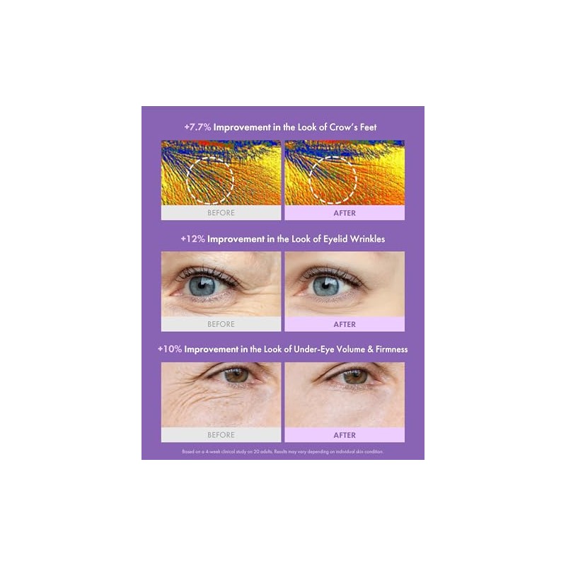 MAXCLINIC PDRN Crema de ojos - Advanced C-Zone Crema hidratante