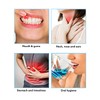 Azulenal Solution for Mouth Ulcer Treatment | Stomach Ulcers, Gingivitis,