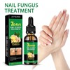 Ginger nail treatment nail support nail care Moisture Blend Cosmetic