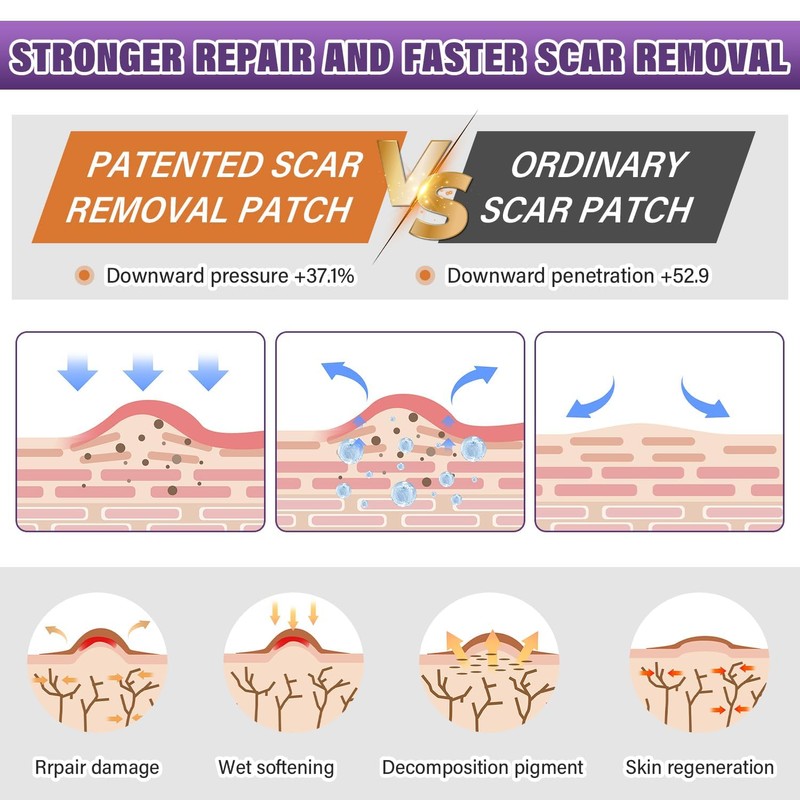Silicone Scar Sheets,Silicone Scar Tape,Silicone Scar Removal Strips for Surgical,C-Section,Tummy