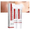 Crema Facial Despigmentante Y Anti Manchas Pack 2 Pzs Todo