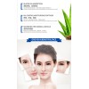 Pack 10 Mascarillas Coreanas Images Anti-acne Control Grasa