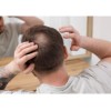 Complemento Alimenticio Cápsulas De Gelatina Blanda Para El Cabello Y