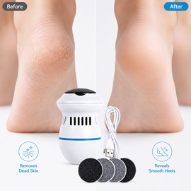 Electric Foot File for Smooth Heel Care – Rechargeable Callus Remover with Vacuum Collection for Home Pedicure Use