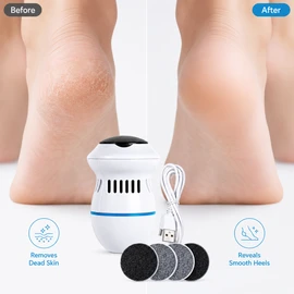 Electric Foot File for Smooth Heel Care – Rechargeable Callus Remover with Vacuum Collection for Home Pedicure Use