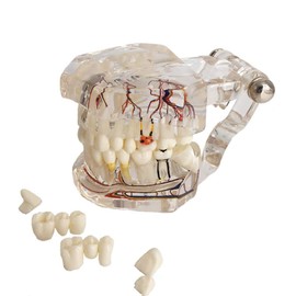 Modelo de implante de dientes, para enseñanza, modelo de enfermedad, estándar, extraíble, patología de YOUYA DENTAL