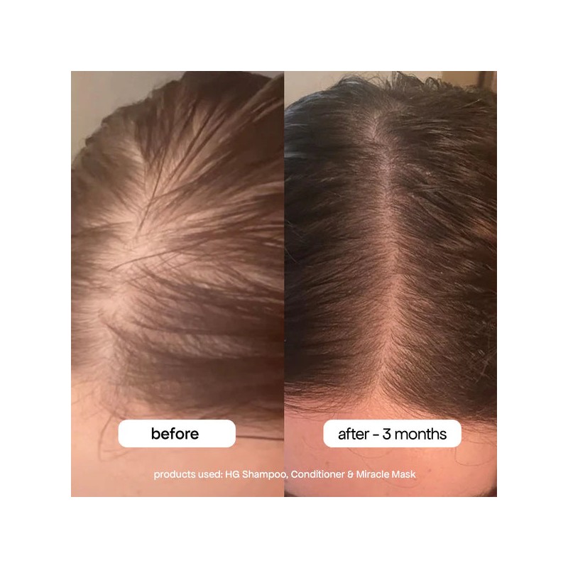 Bondi Boost Hair Growth Conditioner 300ml