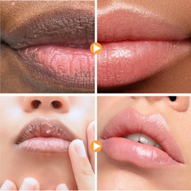 Ginger Lip Lightening for Dark Lips,Lips Pink Bleaching Cream Balm,Lip Balm,Fast Moisturizing Lightening Lip Balm,Brightening Cream Blam,Lip Care Lightens Remove Dark Lips,Lip Pigmentation Treatment