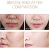 Exfoliante Corporal Facial Purificante, Limpiador de Suciedad y Aceites (2PCS)