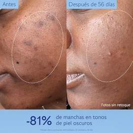 Caudalie Vinoperfect Serum Facial Resplandor Antimanchas, Alternativa Vitamina C Serum Facial - 30 mL