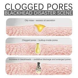 Dressing Hydro Mask (25.04-06)