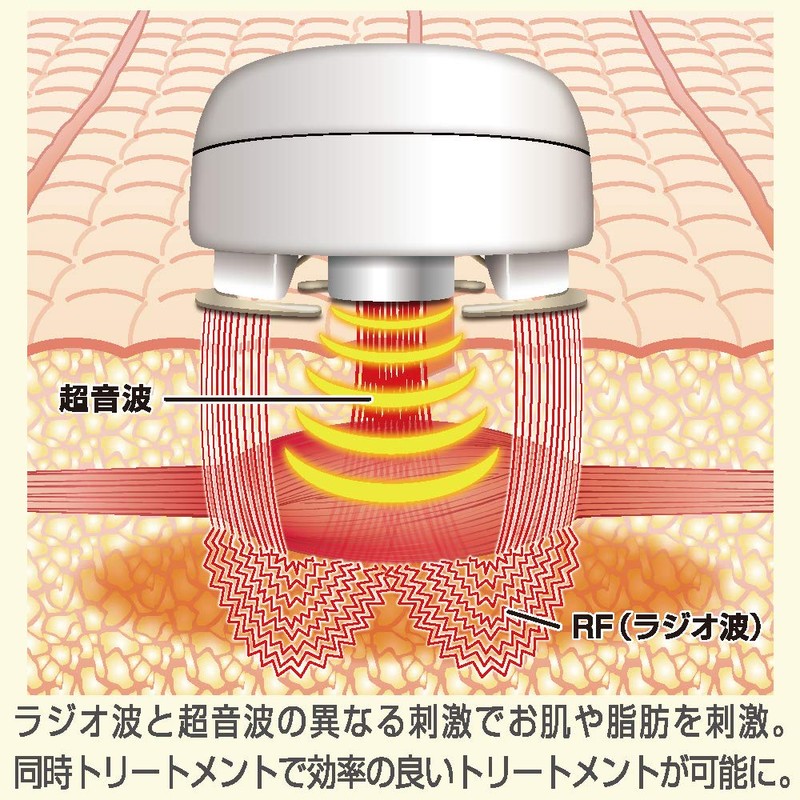 Radio Wave & Ultrasonic Beauty Device Super Lift RF