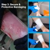 Rhino Rescue Kit Quemaduras Apósitos 4x4 Paquetes Gel Almohadillas Adherentes