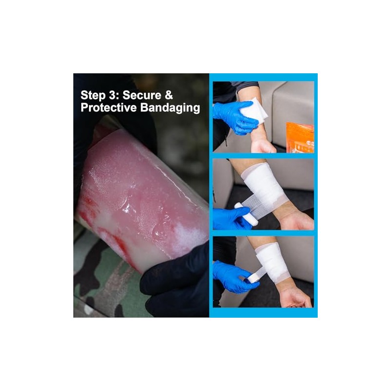 Rhino Rescue Kit Quemaduras Apósitos 4x4 Paquetes Gel Almohadillas Adherentes