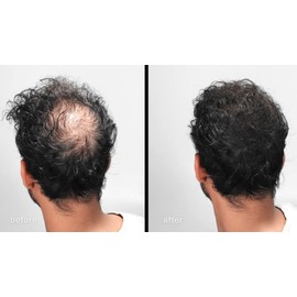 LUXE Haarverdichtungs-Fasern mit natürlichen Keratin - Vom Hautarzt getestet - Zertifiziertes Hypoallergen - 2 Monate + Vorrat! - Zuversicht in einer Flasche! - In mehrere Farben erhältlich - Grau