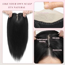 Hair Toppers for Thinning Hair Women Real Hair 16In Hair Toppers 7x7inch Skin Scalp Big Base Cover Thinning Hair or Hair Loss Top Hair Pieces Wiglets Remy Hair Topper Cover Large/scalp reality
