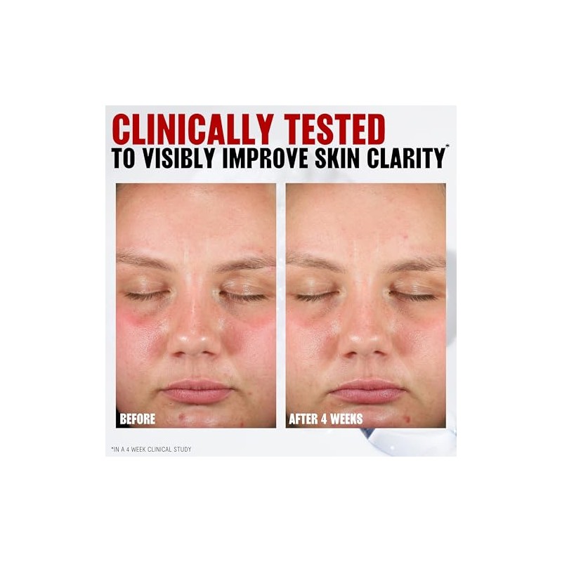 Thayers Pore Refining Exfoliating Toner Pads for Clear Skin