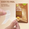 Naterido Large Blemishes Hydrocolloid Strips XL Cover-24Couts, Thicker & Extra