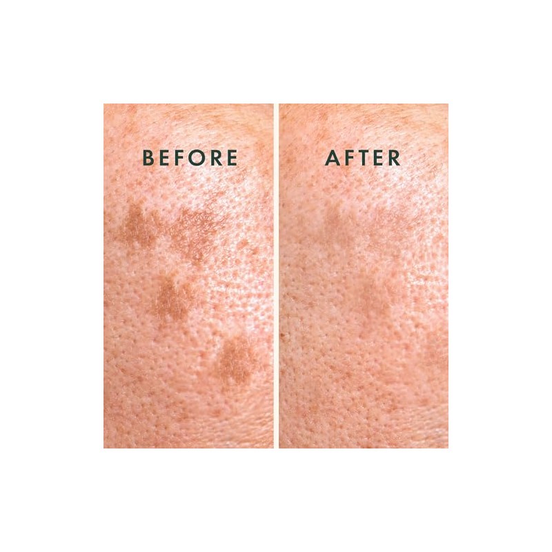 Rael- Parches para el acné, Miracle Microcrystal Spot Cover -