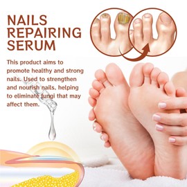 7 Days Nail Growth and Strengthening Serum, Nagelserum für Stärke und Wachstum, Nail Repair Essence Serum - Nagelöl für Fuß & Fingernägel, stärkt pflegt rissige brüchige Nägel
