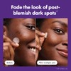 Mighty Patch Original - Micropoint for Dark Spots. Para Puntos