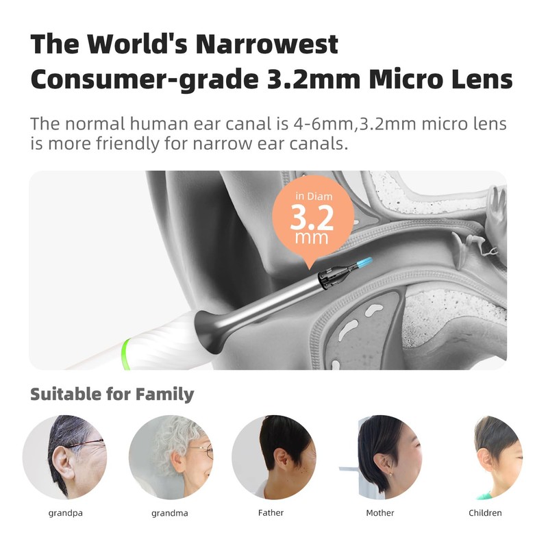 Bebird Pro Note5 Ear Picker with Camera Tweezers, Wireless Wax