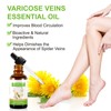 Varicose Veins Essential Oil, Spider Vein Removal Oil for Legs,