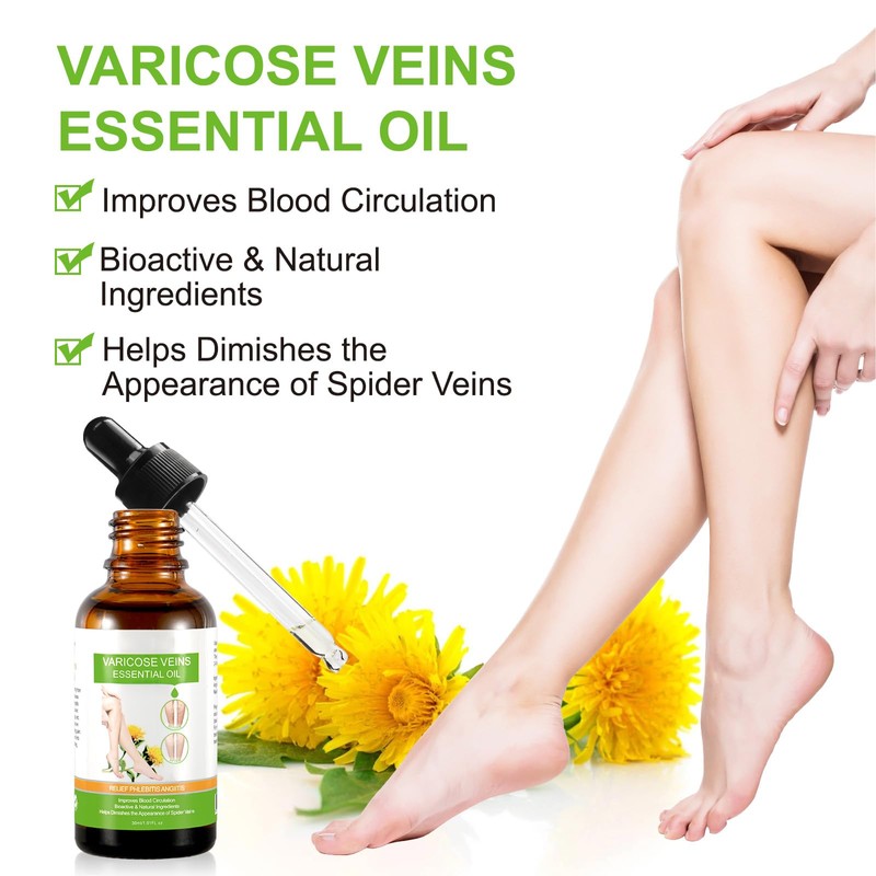 Varicose Veins Essential Oil, Spider Vein Removal Oil for Legs,