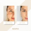 Kedma - Intensive Night Cream with Dead Sea Minerals and