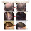 Andrea Paquete 5pza Andrea Solución Crecimiento Del Cabello Full