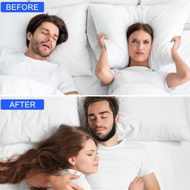 2 PCS Airflow Jaw Strap, Airflow Chin Strap, Air Flow Jaw Strap, Breathable Stop Snoring Chin Strap, Adjustable Chin Sleep Strap to Keep Mouth Closed for Men and Women