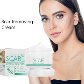 Mnozreo Narbengel für das Gesicht, Silikon-Narbenentferner, Creme zur Entfernung von Narben, gegen Dehnungsstreifen, Narbenreparatur, 30 ml