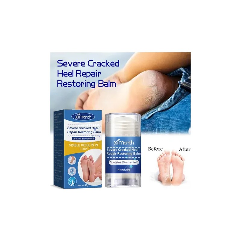 2×crema Reparadora Grietas Secas Y Talones For Pies Y Mano