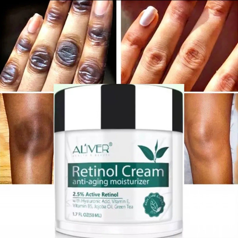 Crema Retinol Aclarante Zonas Intimas Perianal Entrepierna Neutra