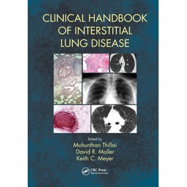 Clinical Handbook of Interstitial Lung Disease