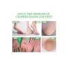 Crema Confiable Antigrietas Para Manos Y Pies Eelhoe